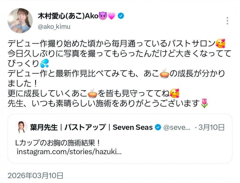 被指隆乳不忍了！木村爱心直球对决！
